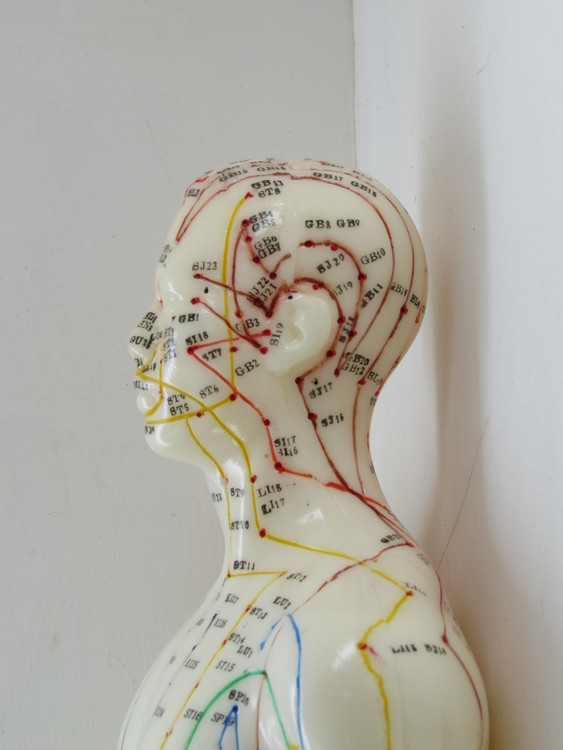 قیمت مولاژ طب سوزنی