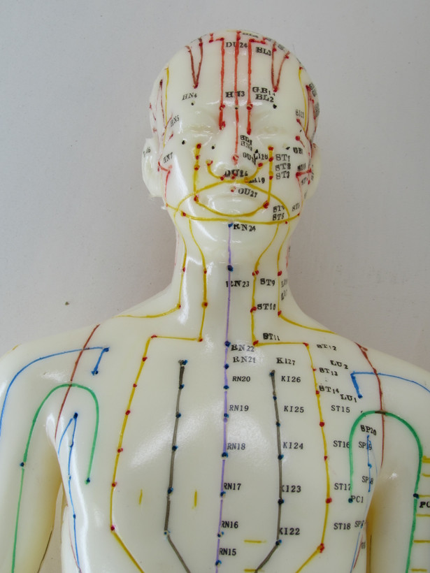 طب سوزنی